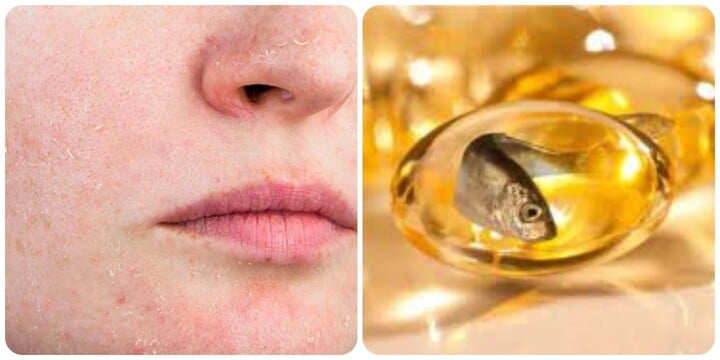 5 dấu hiệu cho thấy cơ thể bạn đang thiếu Omega-3 1 5 dấu hiệu cho thấy cơ thể bạn đang thiếu Omega-3 5 dau hieu cho thay co the ban dang thieu omega 3