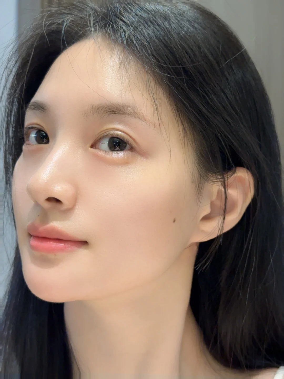 Phẫu thuật hàm mặt: Giải pháp chỉnh hình toàn diện từ cấu trúc xương 1 Phẫu thuật hàm mặt: Giải pháp chỉnh hình toàn diện từ cấu trúc xương phau thuat ham mat giai phap chinh hinh toan dien tu cau truc
