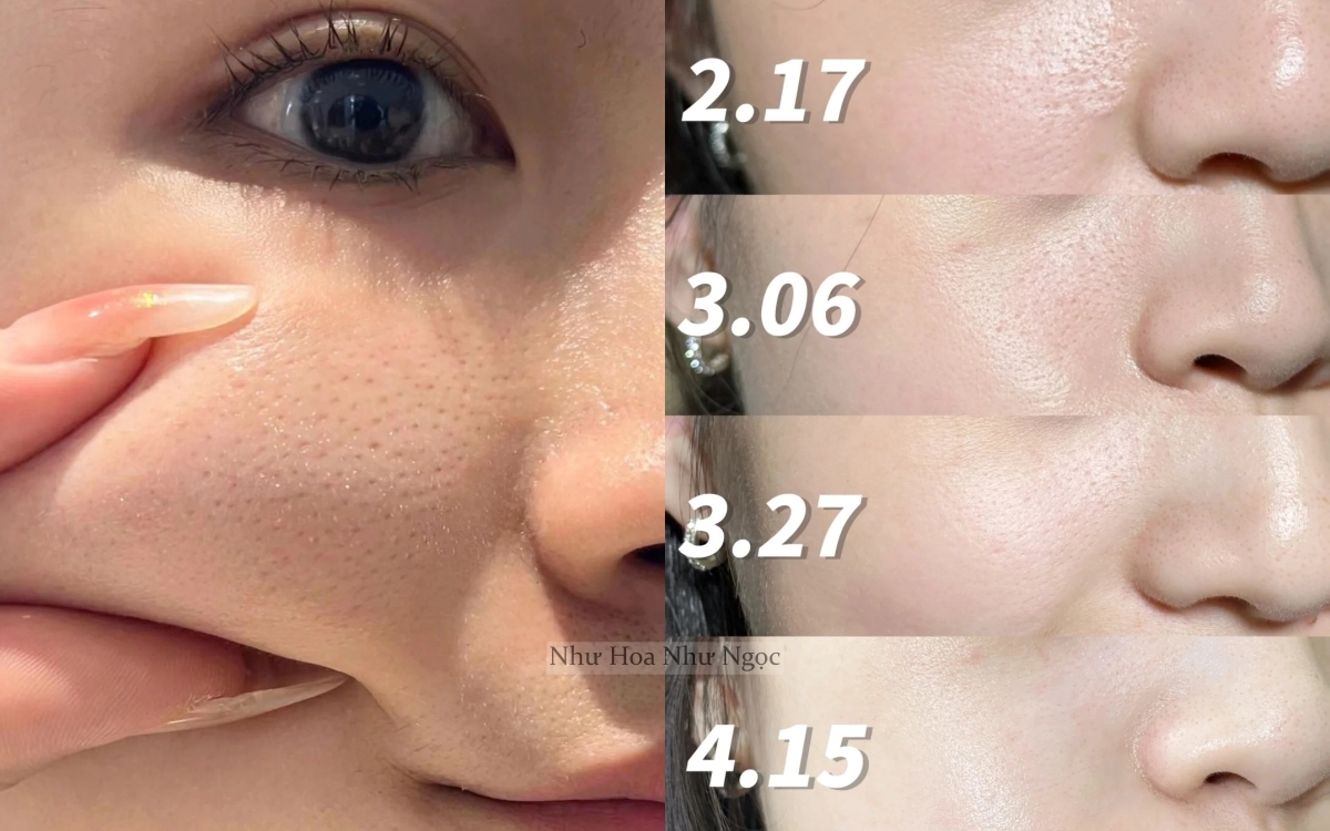 Cô nàng biến lỗ chân lông rộng ngoác thành nhỏ mịn nhờ 5 bước chăm da chuẩn khoa học- Ảnh 3.