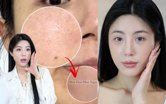 Bài viết 5 Bài viết co nang bien lo chan long rong ngoac thanh nho min nho 5 buoc cham da chuan khoa hoc