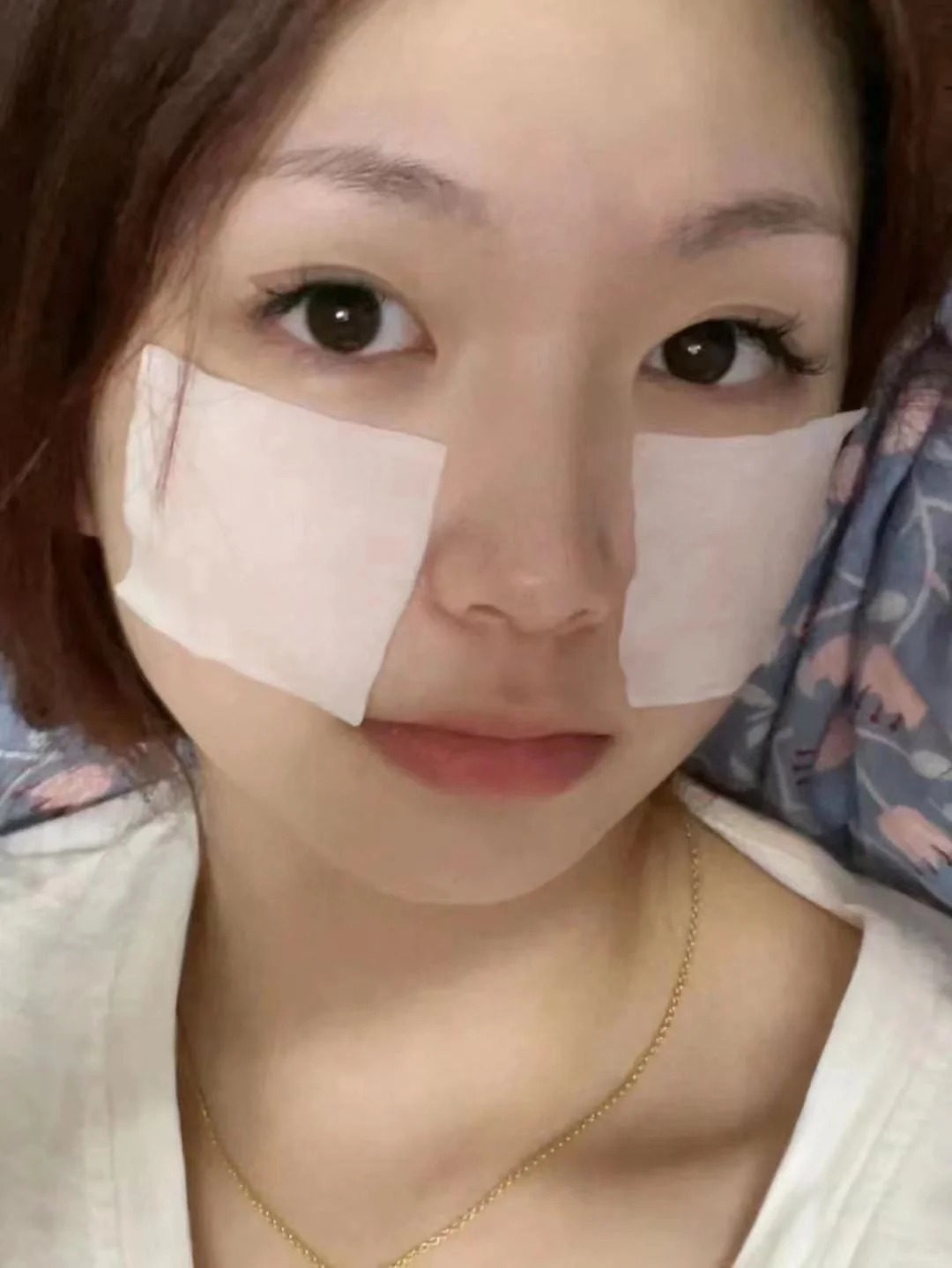 Quy trình chăm sóc da tối giản dành cho người mới làm thẩm mỹ vùng mặt- Ảnh 3.