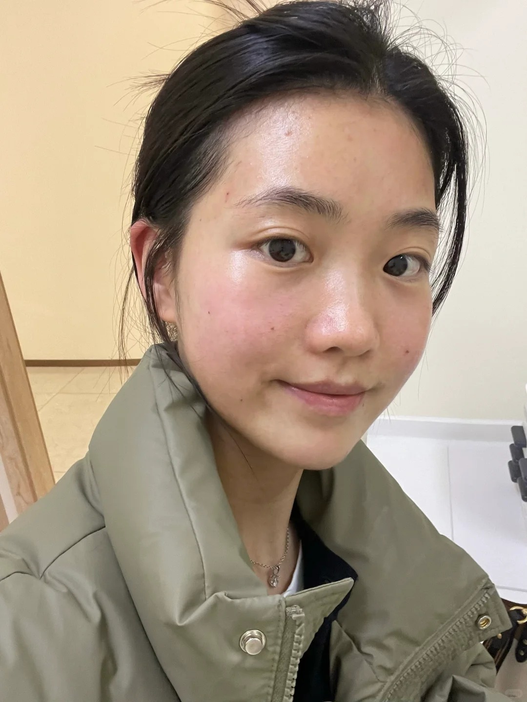 Quy trình chăm sóc da tối giản dành cho người mới làm thẩm mỹ vùng mặt- Ảnh 4.