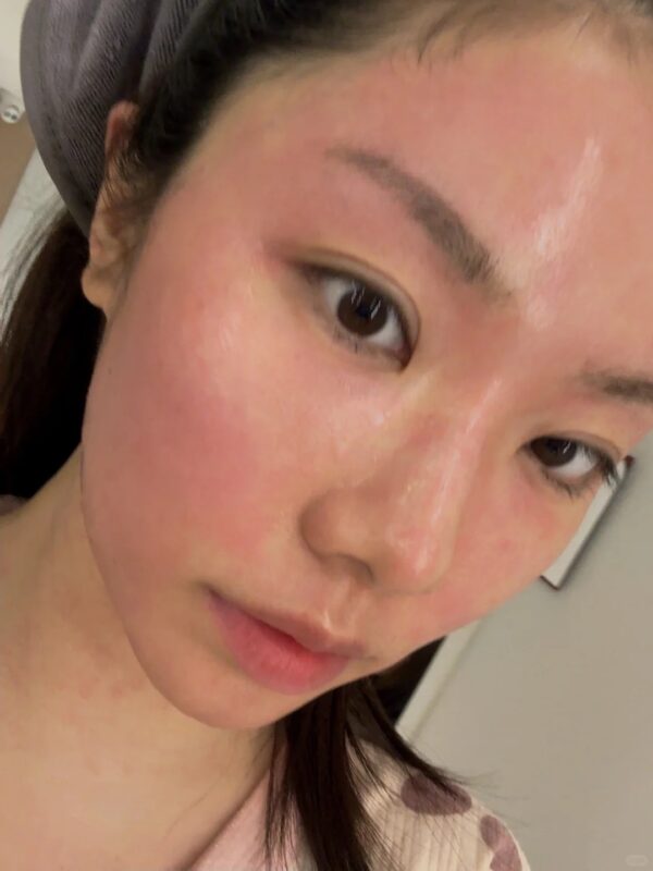 Quy trình chăm sóc da tối giản dành cho người mới làm thẩm mỹ vùng mặt 1 Quy trình chăm sóc da tối giản dành cho người mới làm thẩm mỹ vùng mặt quy trinh cham soc da toi gian danh cho nguoi moi lam tham my vung mat