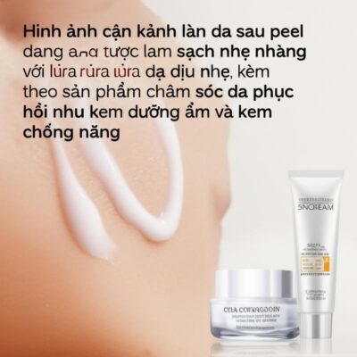 Bài viết da mat sua rua mat sau peel cham soc 2026